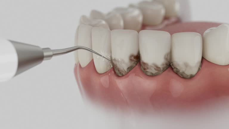Reliable Dental Implants contractor in Leon County County, TX by Dentist Open Now
